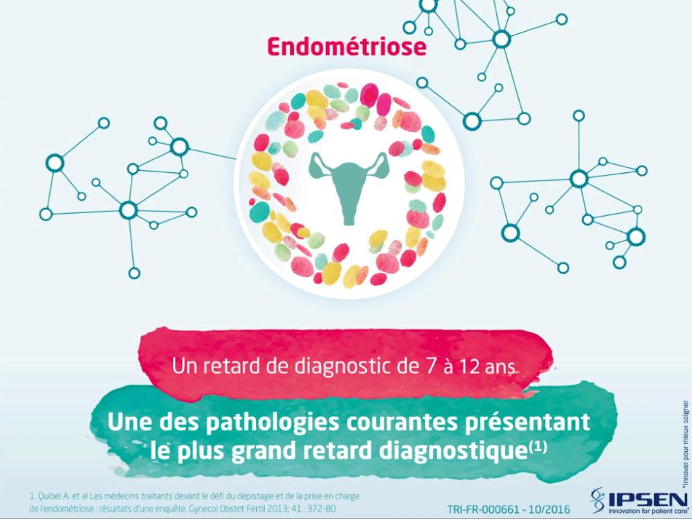 Endométriose : comment éviter le retard de diagnostic ?